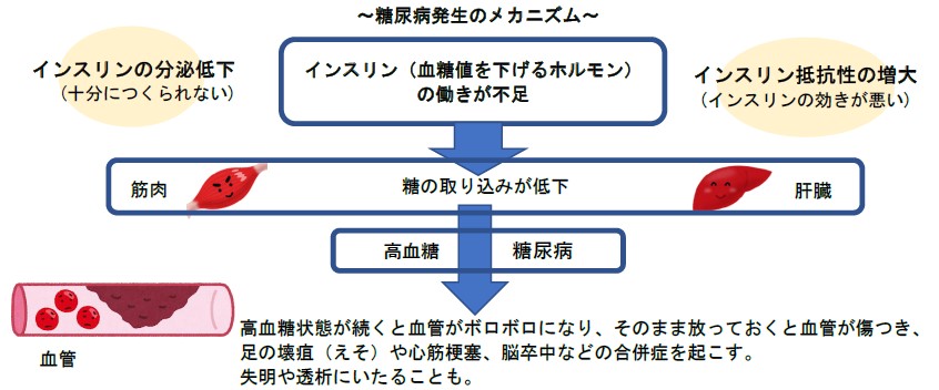糖尿病発症のメカニズム